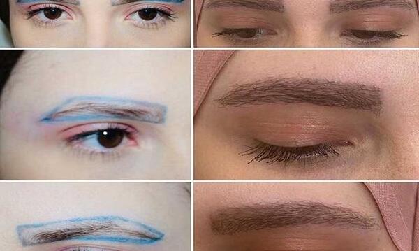عکس کاشت ابرو با موی طبیعی