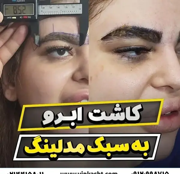 عکس های کاشت ابرو طبیعی
