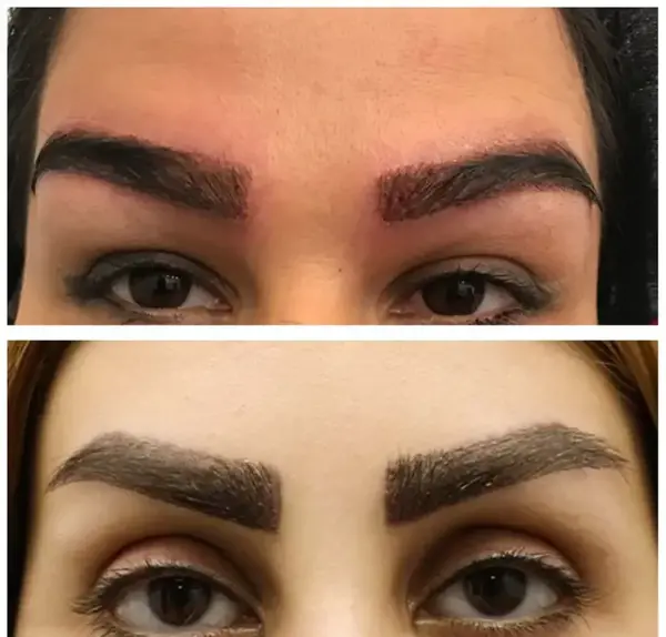 عکس های کاشت ابرو طبیعی