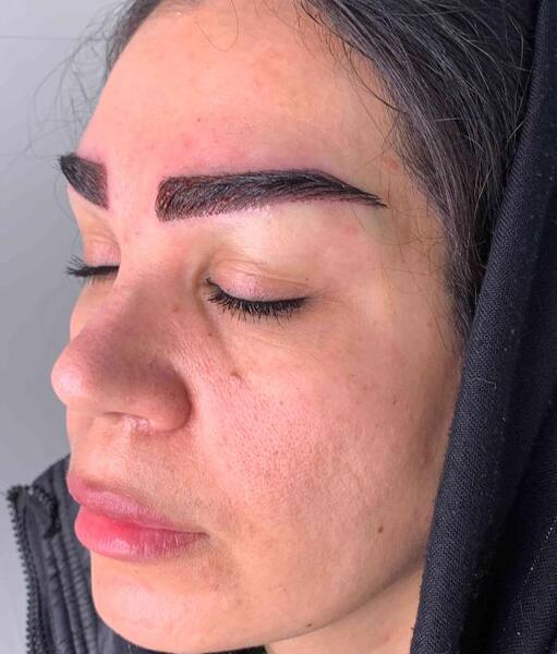 عکس های کاشت ابرو طبیعی