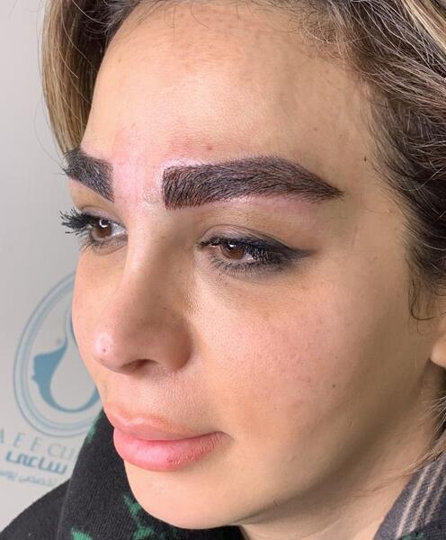 عکس های کاشت ابرو طبیعی