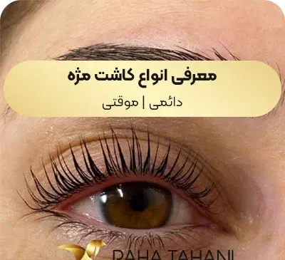 عکس عكس كاشت مژه