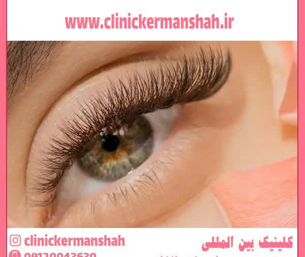 عکس عكس كاشت مژه