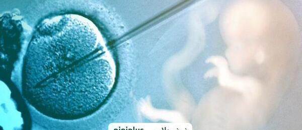 ivf دوقلو عکس بچه های ای وی اف