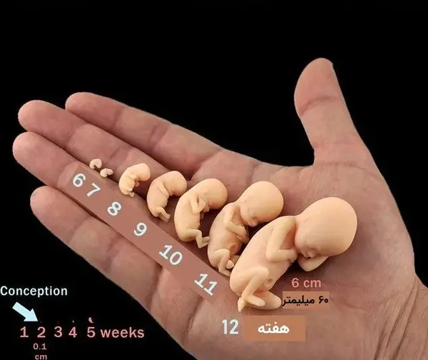 عکس بچه سه ماهه تو شکم مادر