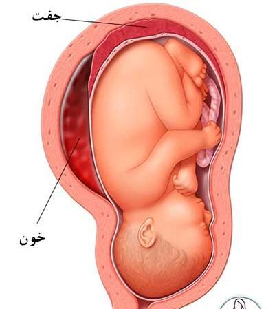 عکس بچه سه ماهه داخل شکم مادر