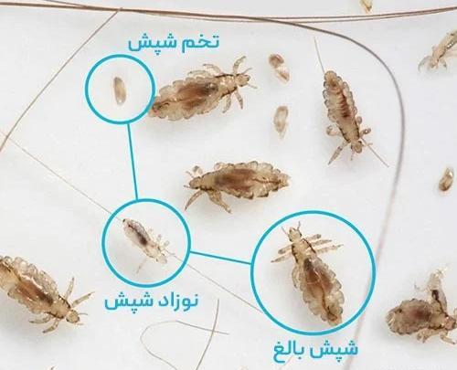 عکس بچه های شپش