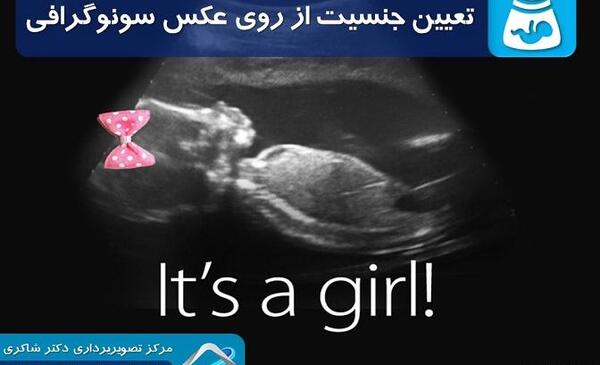 عکس سونو بچه سه ماهه