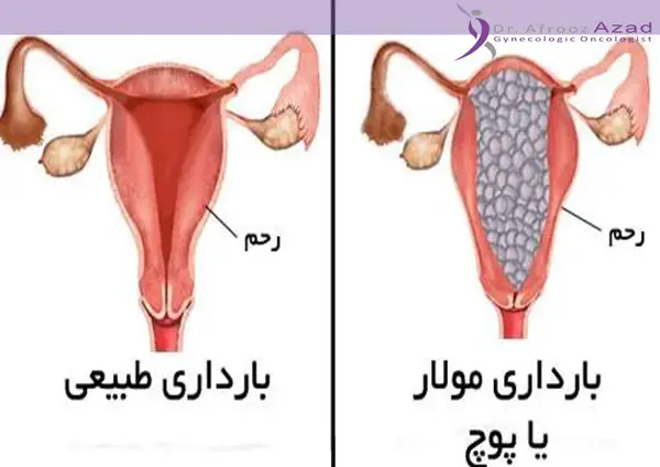 عکس بچه تو شکم آدم