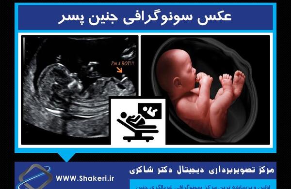 عکس بچه که تو شکم مادر