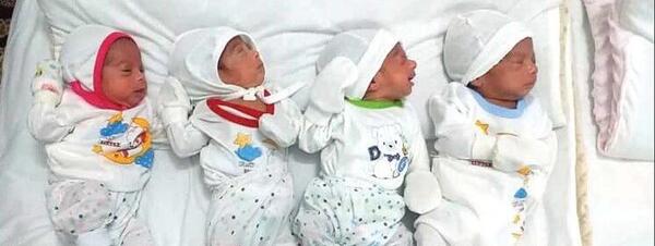 عکس بچه دوقلو تو شکم مادر