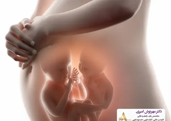 عکس بچه دوقلو تو شکم مادر
