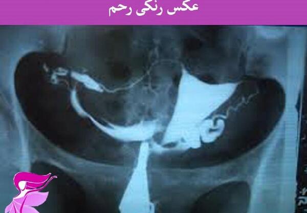 تصویر عکس رنگی رحم