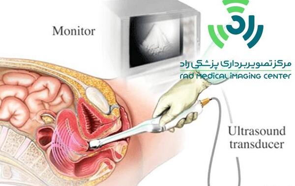 تصویربرداری عکس رنگی رحم