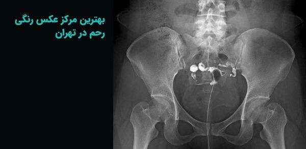 مرکز تصویربرداری عکس رنگی