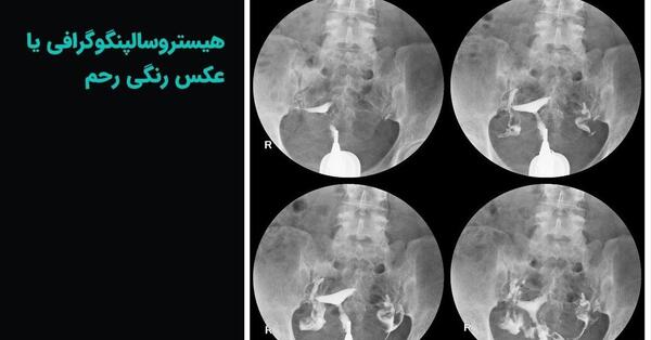 مراکز تصویربرداری عکس رنگی رحم تهران