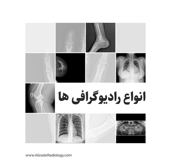 مراکز تصویربرداری عکس رنگی رحم تهران