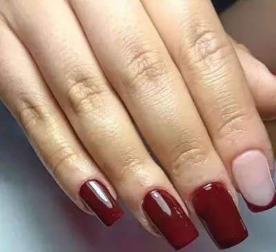 عکس کاشت زرشکی
