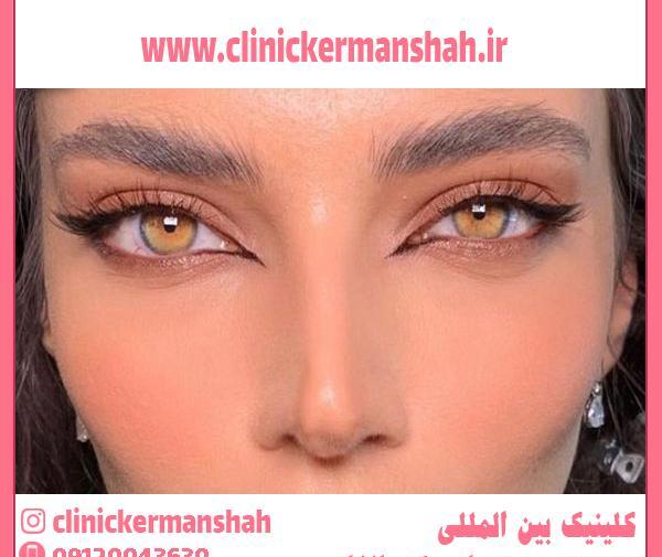 عکس چشم های روباه