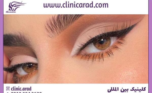 عکس چشمان روباهی