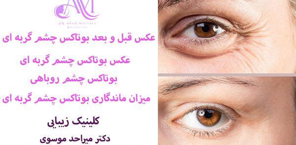 عکس چشمان روباهی