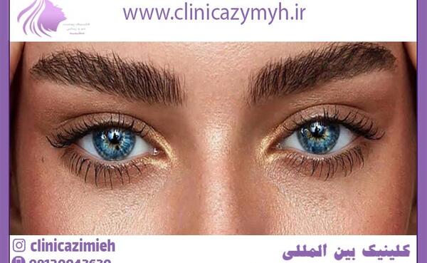 عکس چشمان روباهی