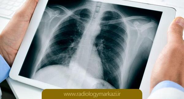 عکس ریه های ناسالم