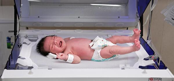 عکس ریه نوزاد نارس