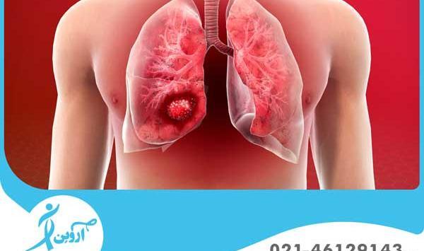 عکس ریه شش