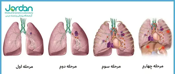 عکس نوار ریه سالم