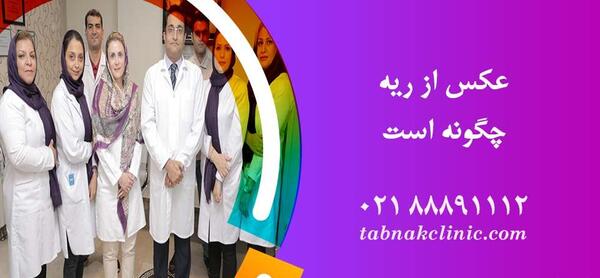 عکس نوار ریه سالم