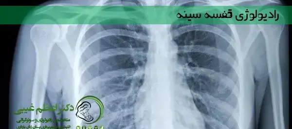 عکس ریه چه چیزی را نشان می دهد