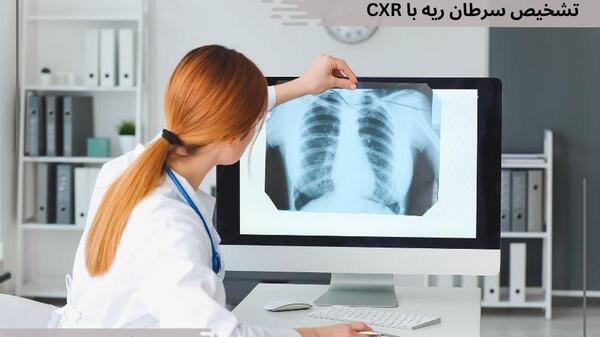 نحوه گرفتن عکس ریه