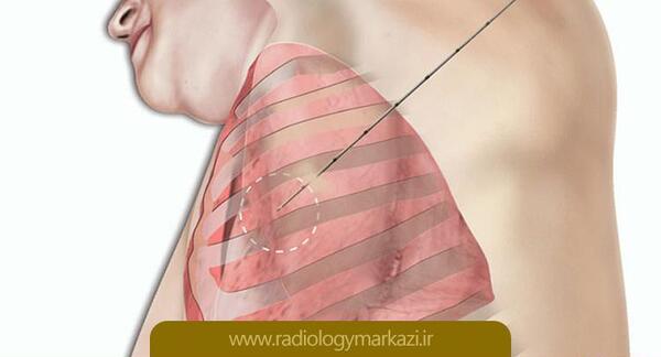 فیلم عکس گرفتن از ریه