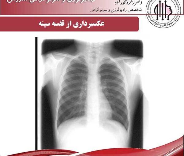 عکس گرفتن از ریه نوزاد