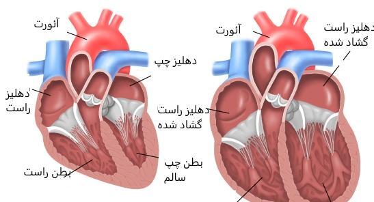 عکس قلب و ریه