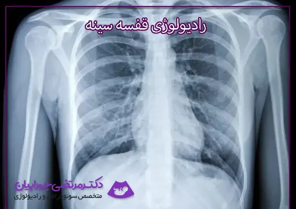 عکس ریه ی فرد سیگاری