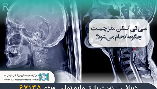 عکس ریه سالم بزرگسال