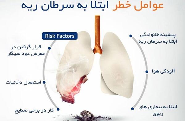 عکس توده سرطانی ریه