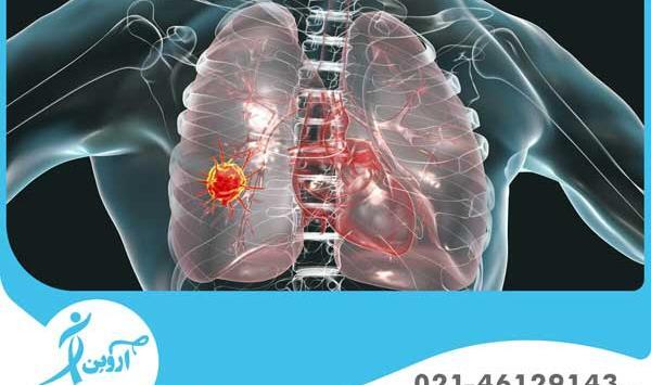 عکس ریه ی سرطانی