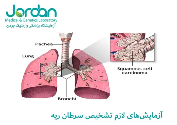عکس ریه ی سرطانی