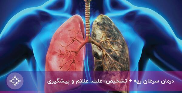 عکس ریه های فرد سیگاری