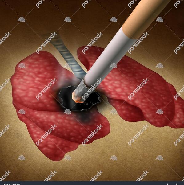 عکس از ریه سیگاری