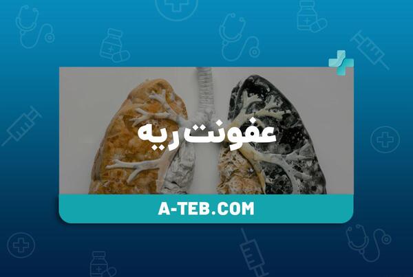 عکس ریه درگیر عفونت