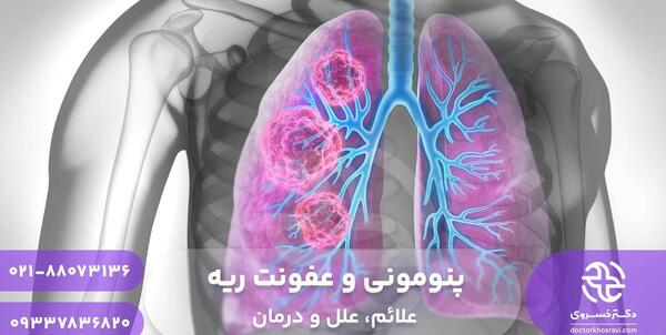 عکس ریه درگیر عفونت