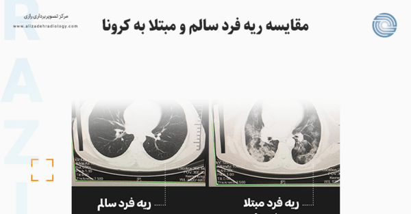 عکس رنگی ریه سالم