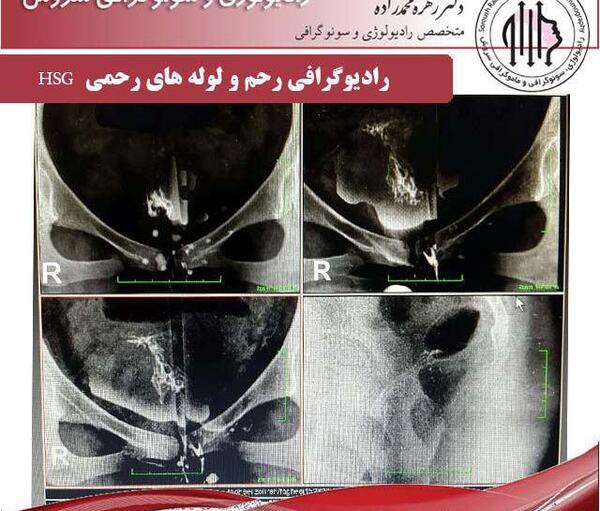 عکس رنگی از ریه