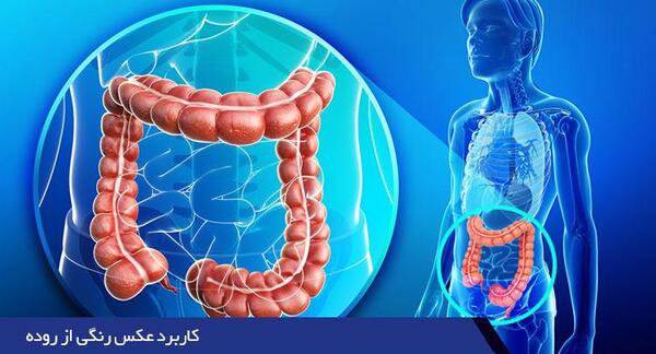 عکس رنگی از ریه