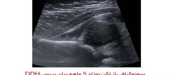 عکس رنگی از ریه نوزاد