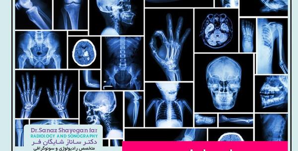 عوارض عکس رنگی ریه